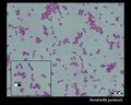 bordetella pertussis